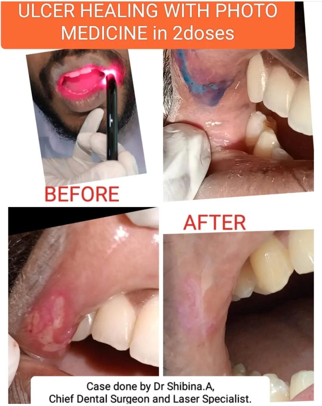 TOOTH CAPITAL GENERAL DENTAL AND LASER CLINIC PATHANAMTHITTA