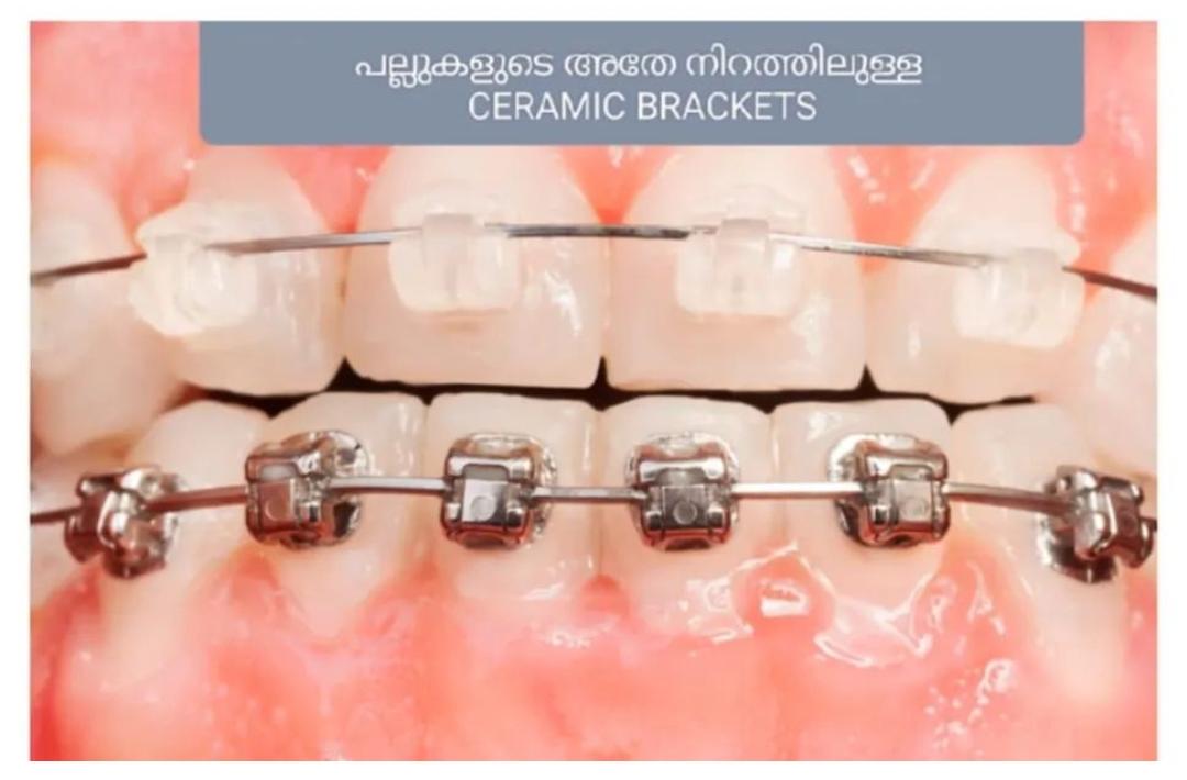 TOOTH CAPITAL GENERAL DENTAL AND LASER CLINIC PATHANAMTHITTA