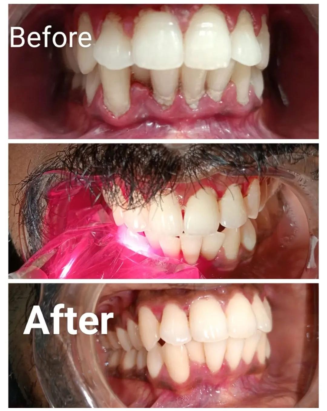 TOOTH CAPITAL GENERAL DENTAL AND LASER CLINIC PATHANAMTHITTA